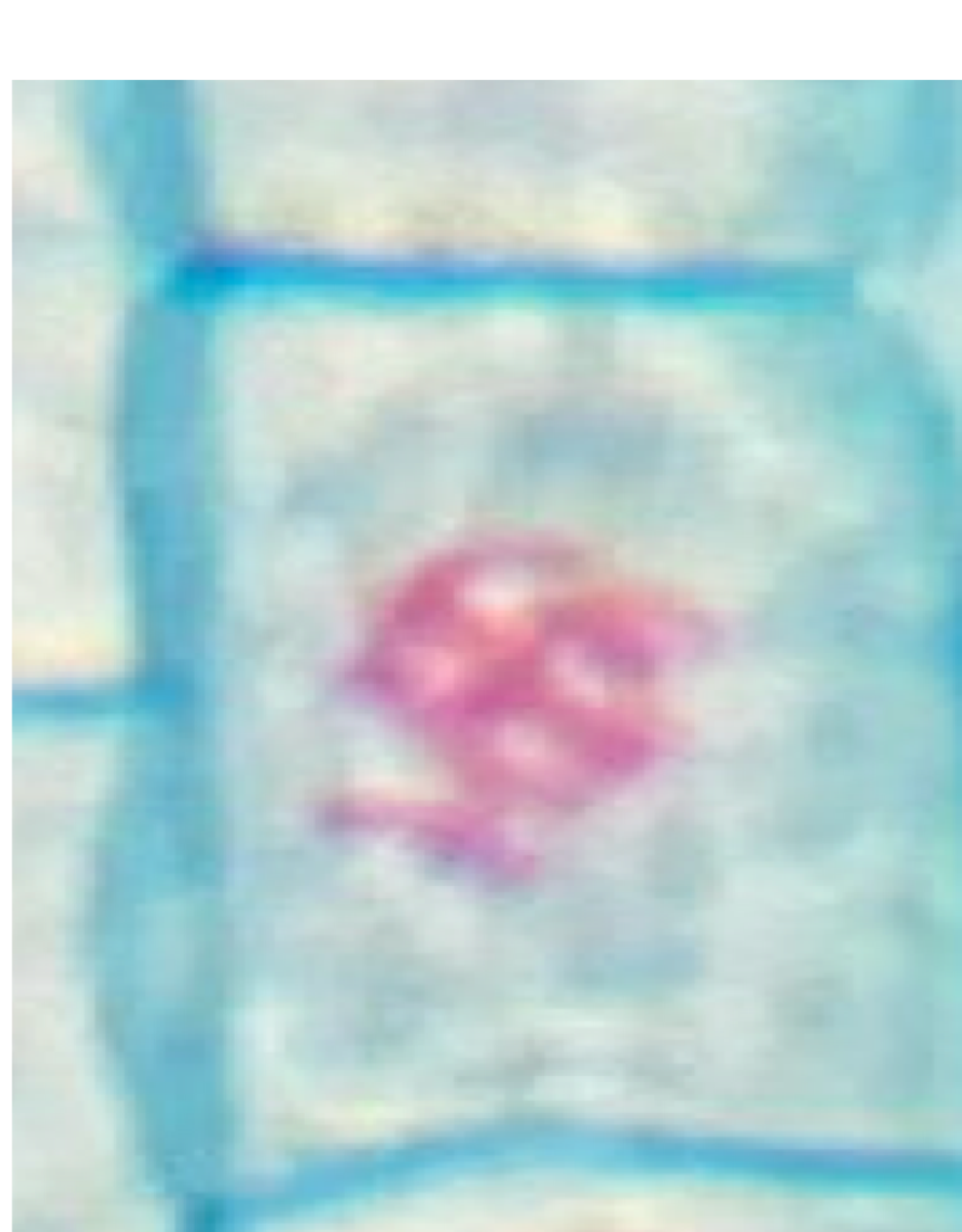 <p>What phase of mitosis is this?</p>