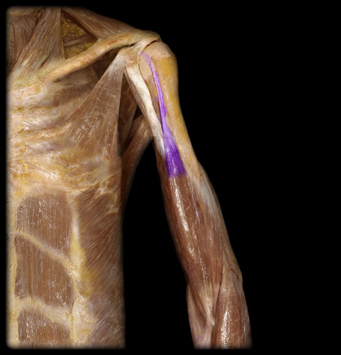 <p>Origin: supraglenoid tubercle of scapula, superior glenoid labrum</p><p>Insertion: radial tuberosity, deep forearm fascia</p>
