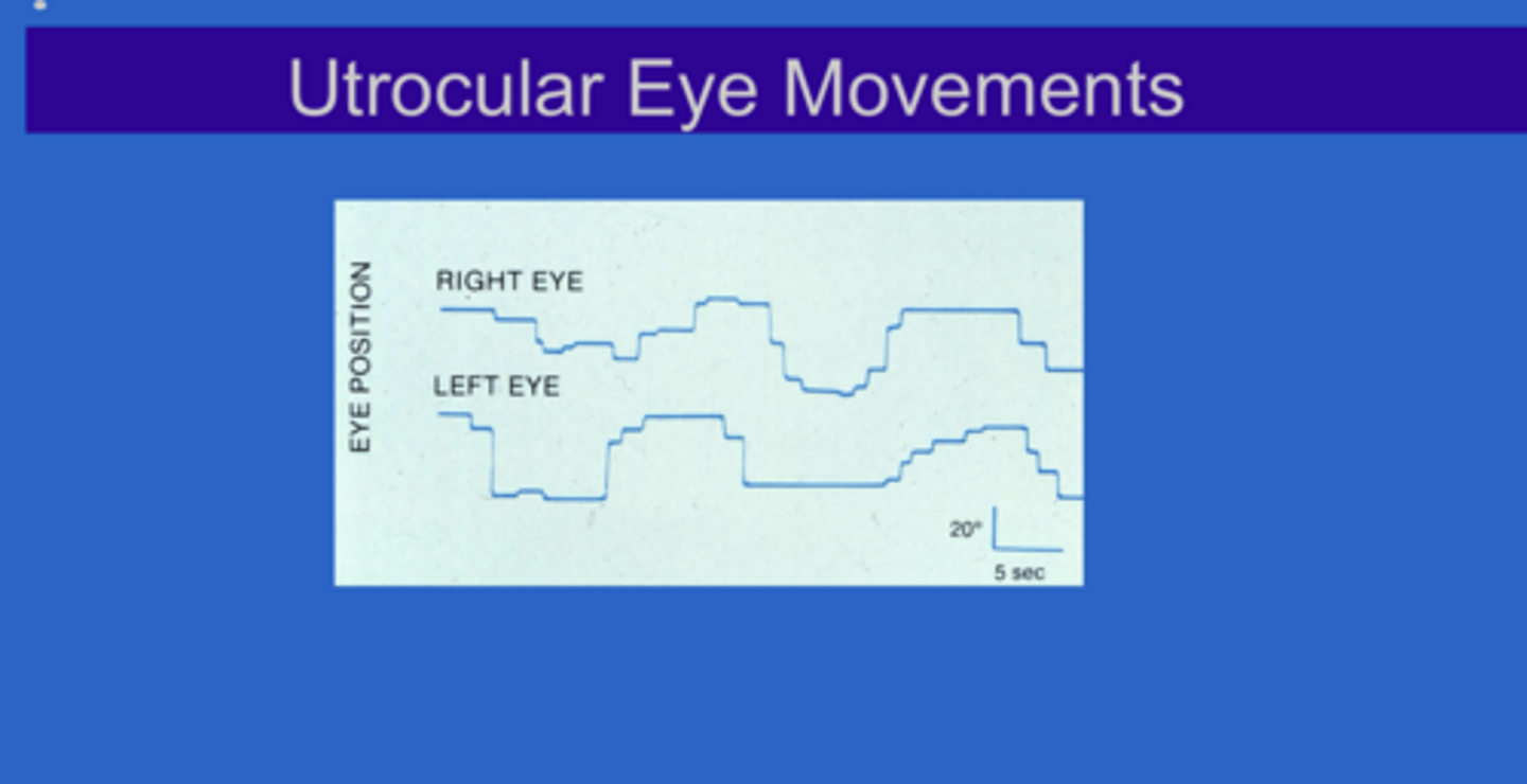 <p>Utrocular Eye Movements (Pic)</p>