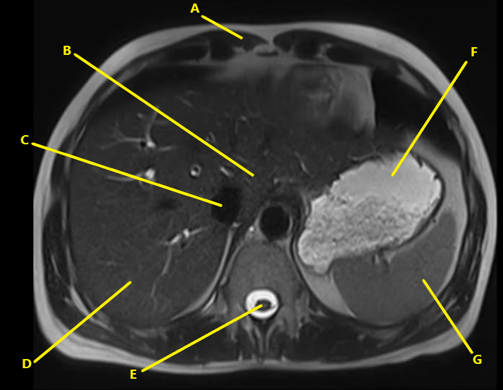 <p>What is letter G ?</p>