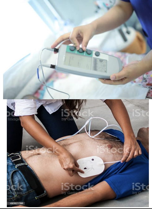 <p>Lead</p><p>Purpose: <span style="background-color: transparent;">Cardiac pacing for abnormal rhythms such as bradycardia, heart block, or unstable rhythms</span></p>