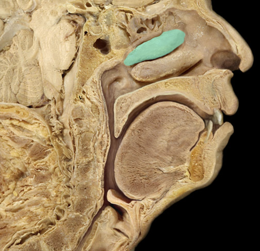 <p>Identify the feature of the nasal cavity</p>