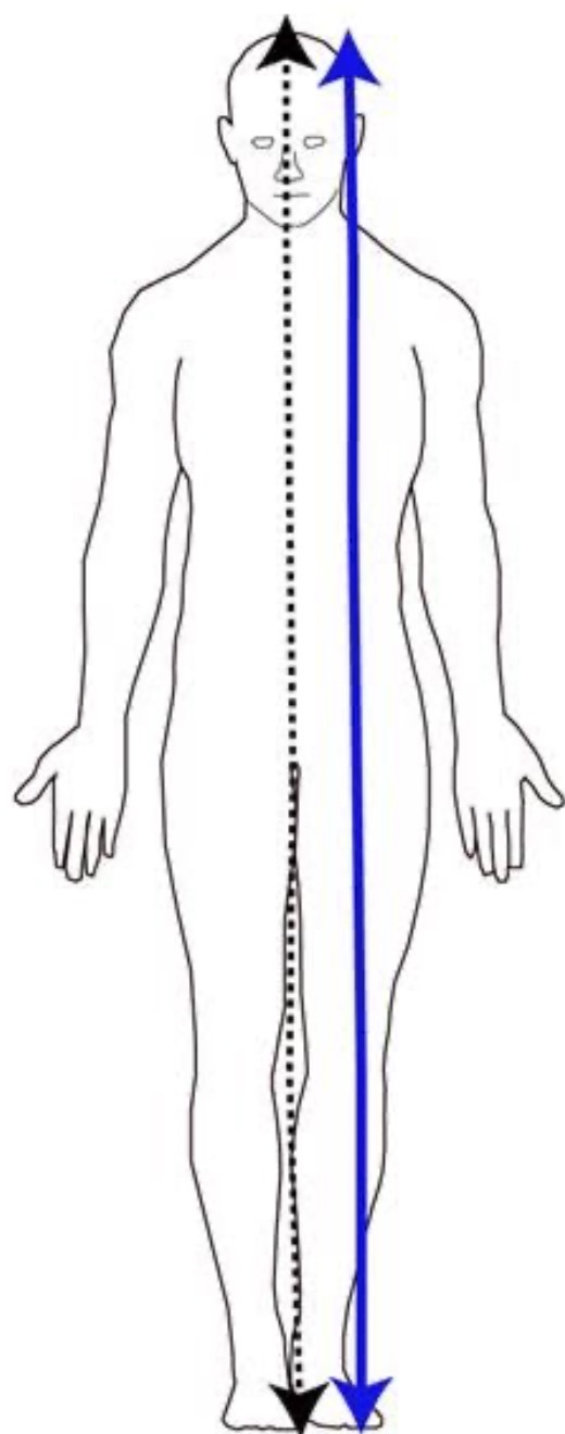 <p>divides the body into <strong>unequal left and right portions</strong></p><p>(Vertical)</p>