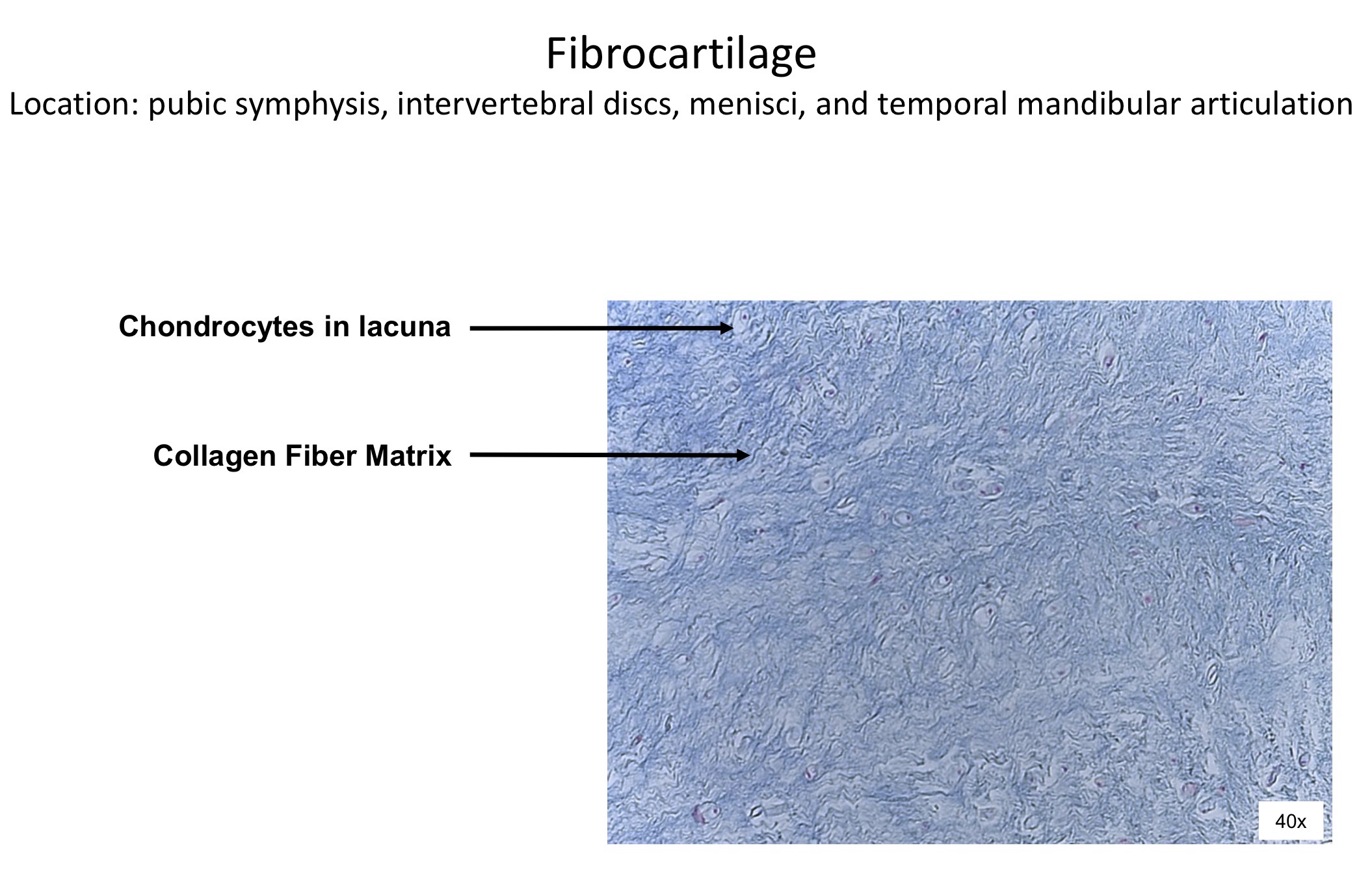 <ol><li><p>Chondrocytes in lacuna</p></li><li><p>Collagen fiber matrix </p></li></ol><p></p>