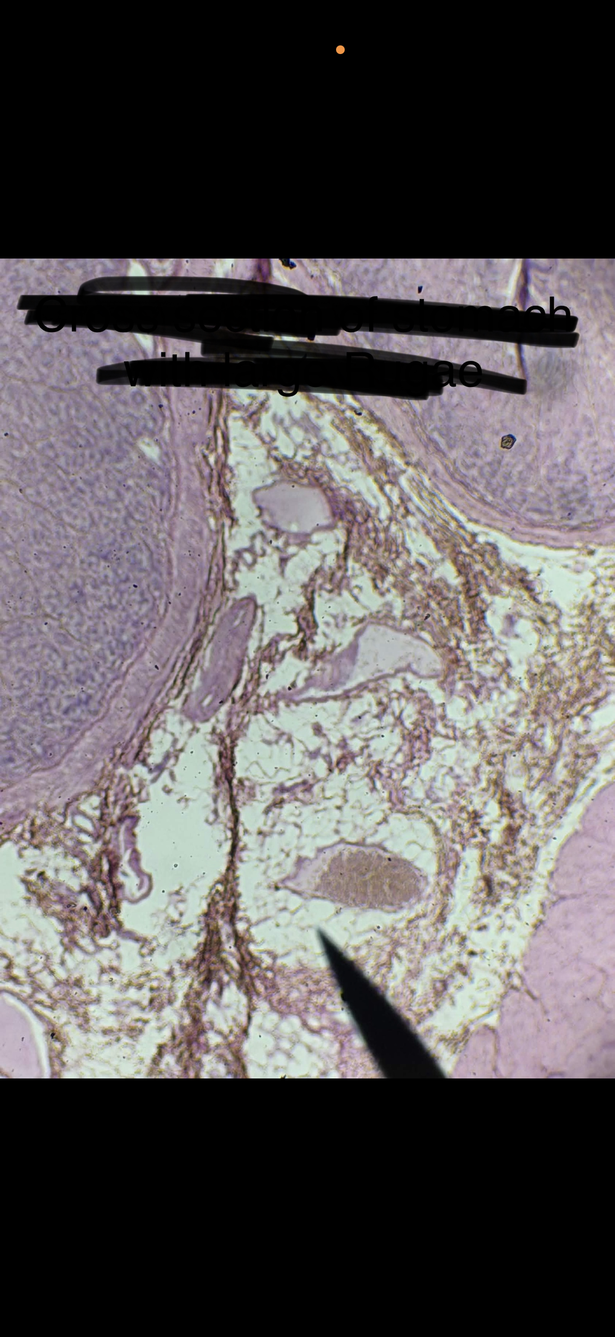 term image