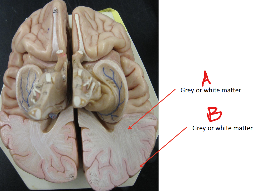 <p>Label A: Grey or white matter?</p>