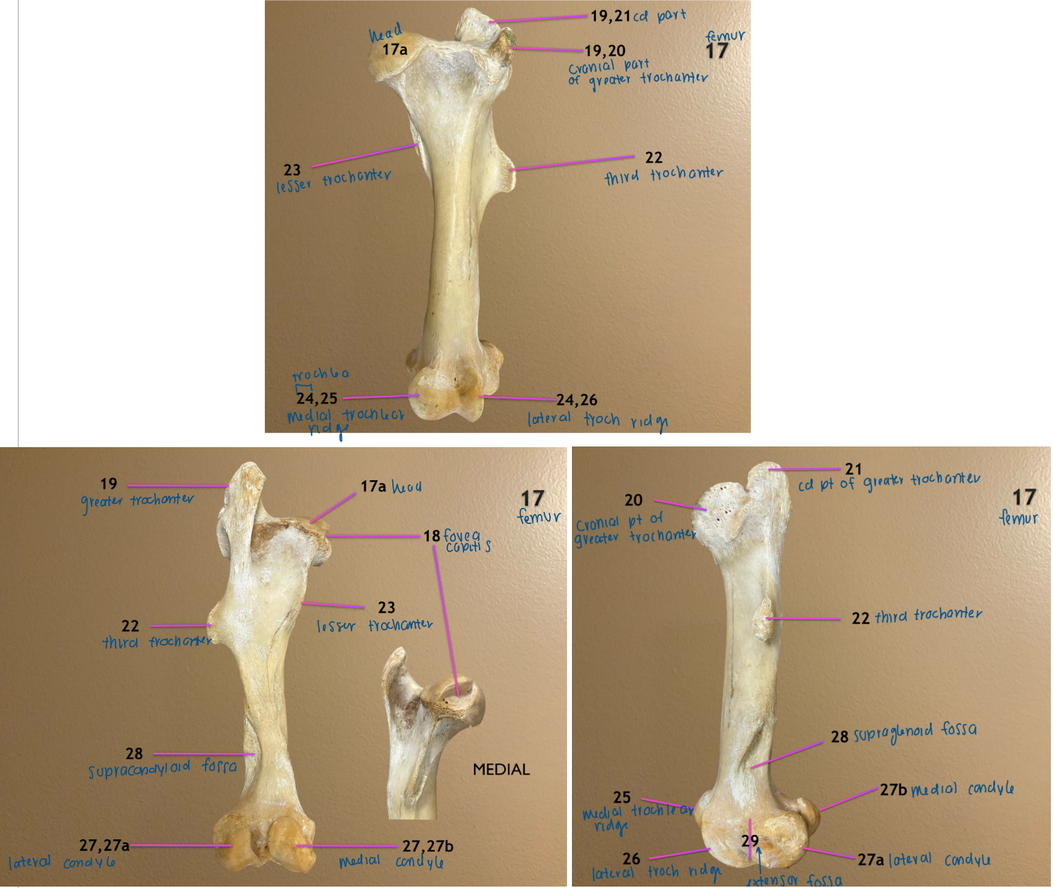 <ol start="24"><li><p>trochlea of femur</p></li><li><p>medial trochlear ridge</p></li><li><p>lateral trochlear ridge</p></li><li><p>condyle of femur</p></li></ol><p>.</p><p><em>bone is the femur</em></p>