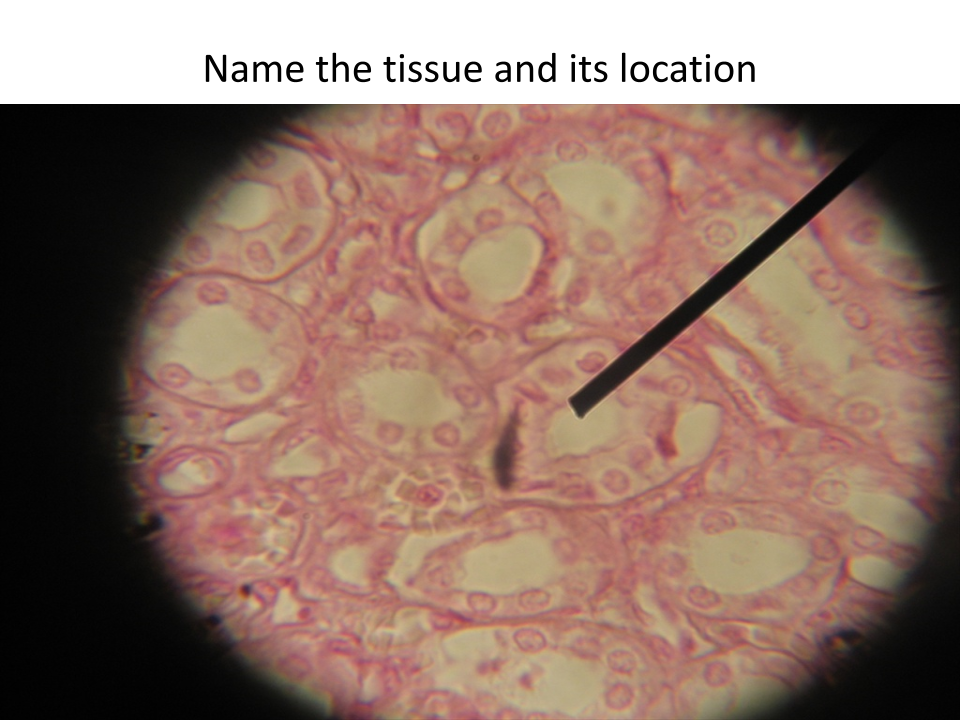 <p>Location of this tissue?</p>