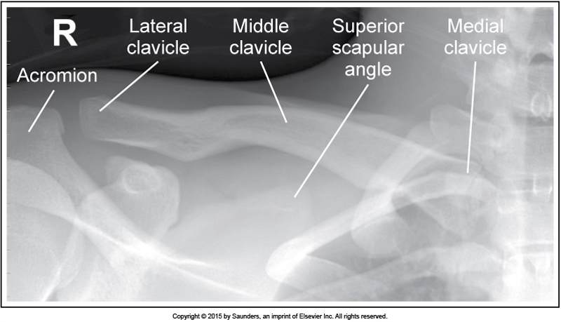 <p>AP axial clavicle</p>