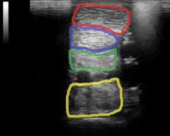 <p>This is a transverse ultrasound image, what are these structures?</p>