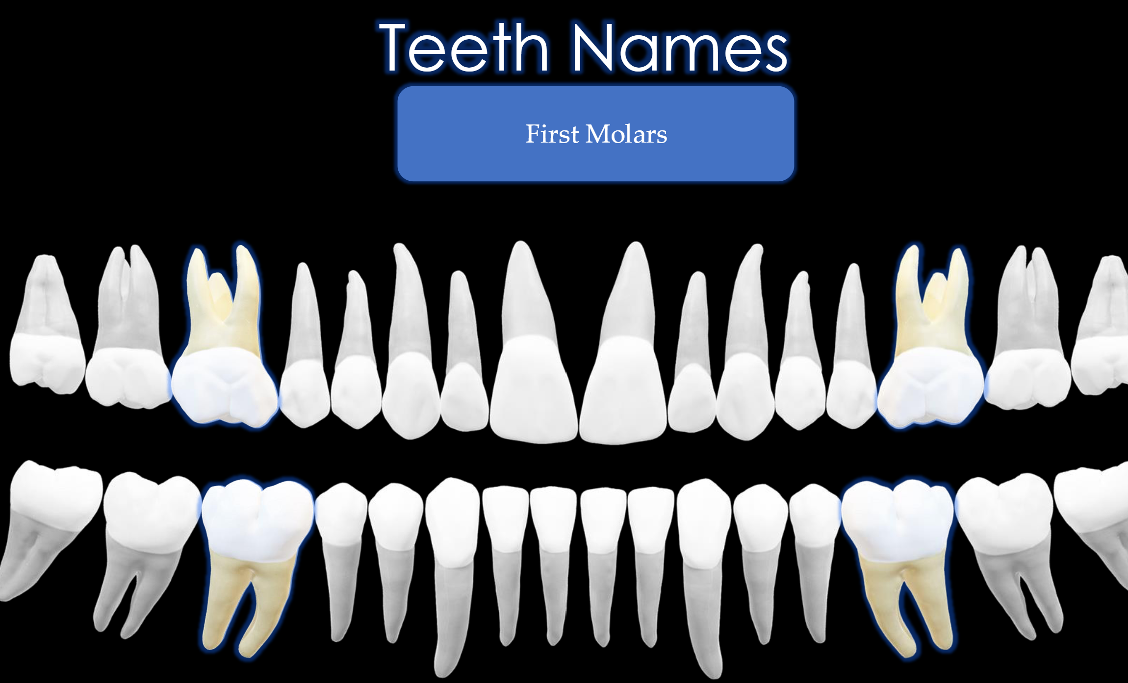 <p>Teeth #: 3,14,18,30</p>