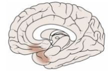 <p>Que etapa del Alzheimer representa esta imágen en relacion con la propagación de la enfermedad en el cerebro?</p>
