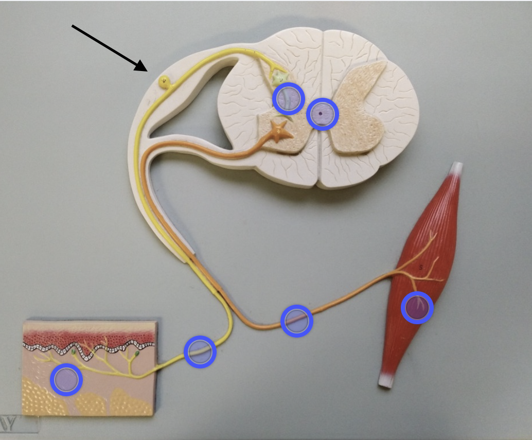 <p>Dorsal root ganglion</p>