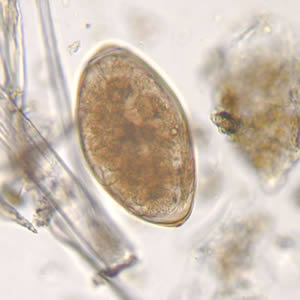<p>Operculation on one end, knob on the other?</p><p>Large egg of intestinal trematode?</p>