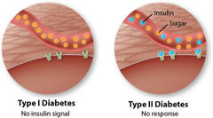 <p>diabetes mellitus</p>