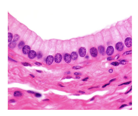 <p>what epithelium</p>