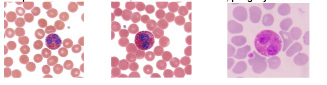 <p>Name the percentage (eosinophil)</p>