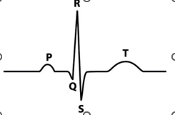 <p><span style="line-height: 115%;">On an EKG, the P wave indicates which of the following electrical events?</span></p>