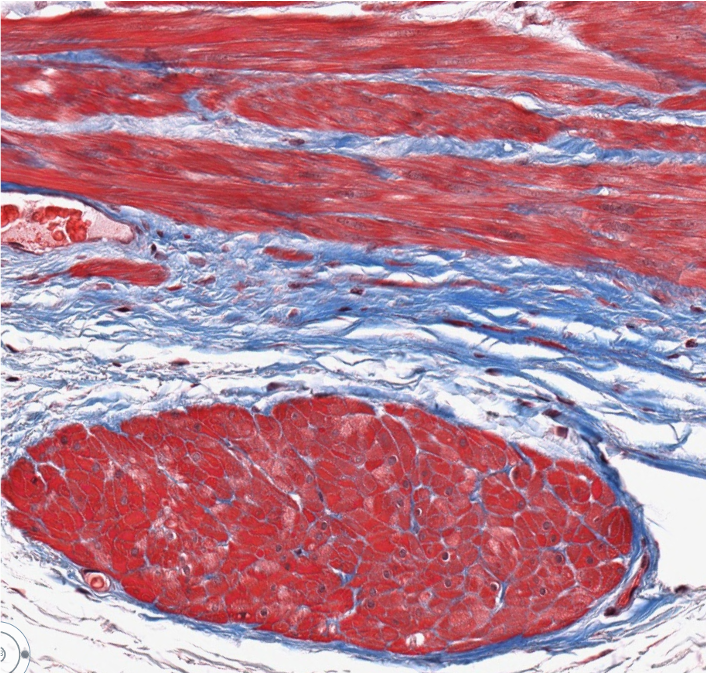 <p><span style="font-family: "Calibri Light";">ID the type of muscle.</span></p>