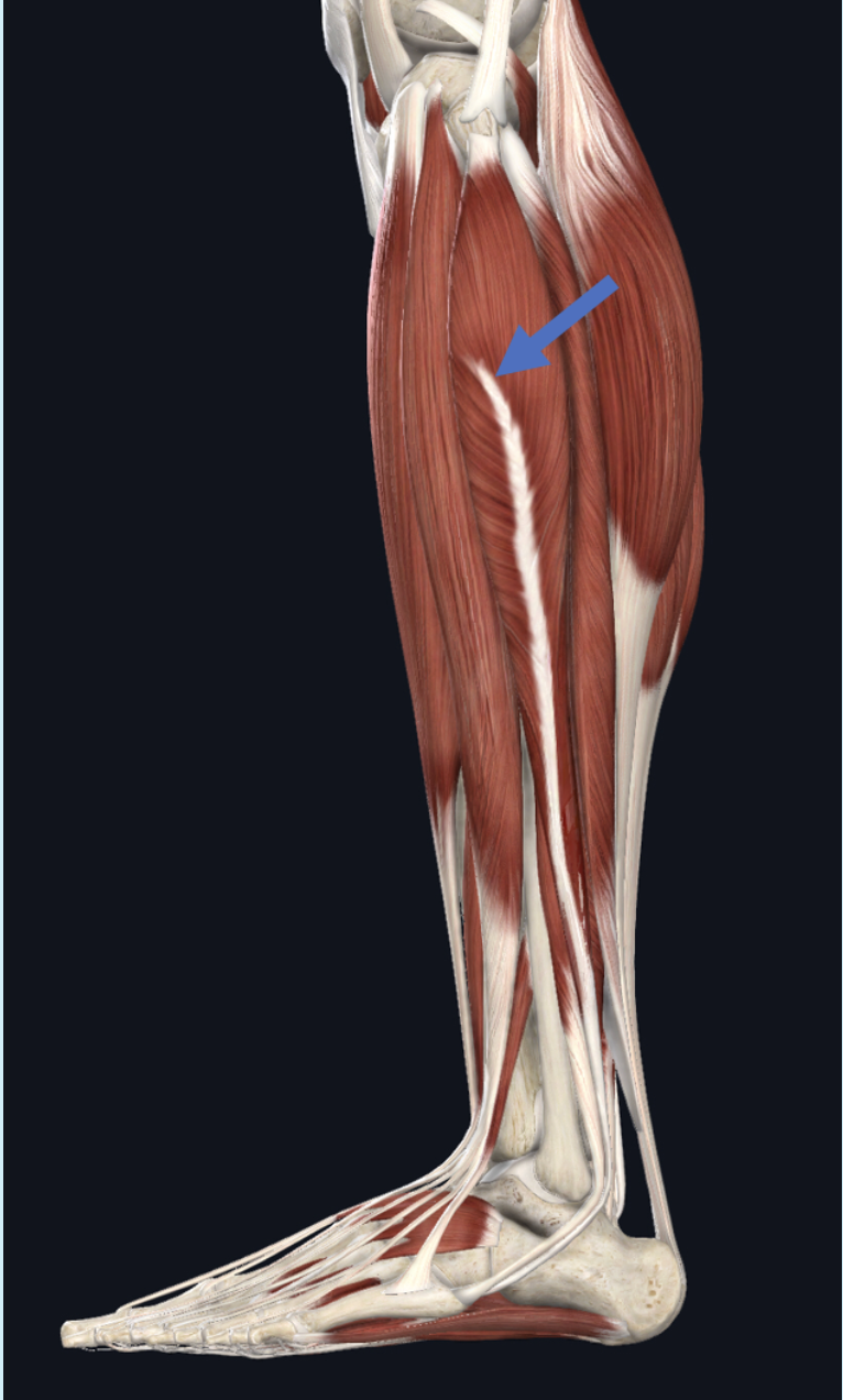 <p>Identify the muscle at the tip of the blue arrow</p>