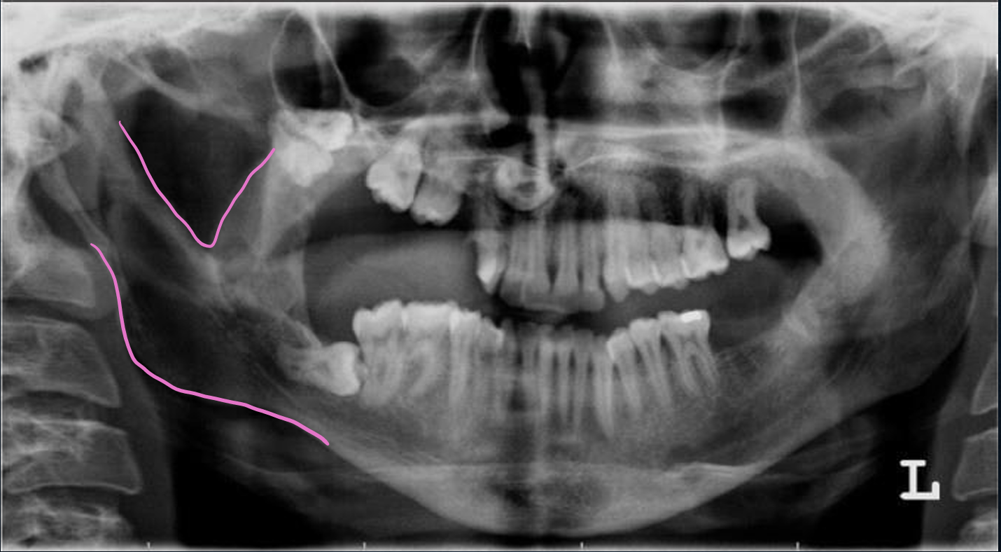<p>what is this, and what are the pink line demonstrating?</p>