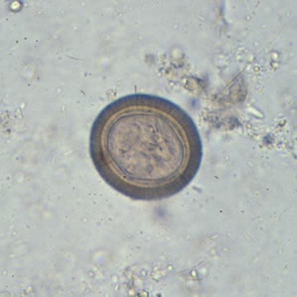 <p>Identify the organism</p>