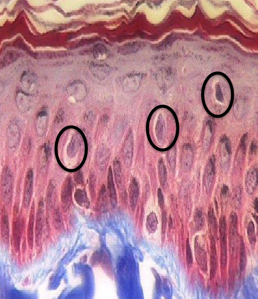 <p>What cell are these? Keratinized or Non-keratinized?</p>