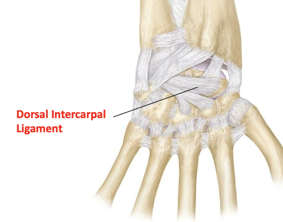 <p>Dorsal intercarpal ligament</p>