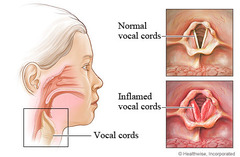 <p>Larynx (voice box)</p>