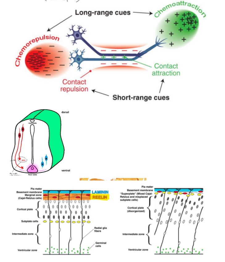 <p>axon pathfinding, where axon reach target areas will require spatiotemporal <span style="color: blue;"><strong><u>axon guidance molecules</u></strong></span> that deter. where to <u>extend, turn, and stop</u></p><ul><li><p><u>short range cues</u>: <strong><u>direct </u></strong><u>repulsion </u>or <strong><u>direct </u></strong><u>attraction </u><span style="color: purple;">← direct contact</span></p></li><li><p><u>long range cues</u>: are <strong><u>chemoattractants </u></strong>or <strong><u>chemorepellants </u></strong><span style="color: purple;">← for the axon</span></p></li></ul><p>VS.</p><p>growth cones steer the direction of the axon by polymerizing microtubules/MTs towards attractive cues &amp; away from repulsive cues, where <strong><u>F-actin</u></strong> <u>look </u>for axon guidance cues in the environment &amp; <strong><u>MTs</u></strong> <u>polymerize </u>to extends towards or away from certain cues</p><p>__</p><p><strong><u>Netrin </u></strong>is the first axon guidance cue discovered</p><ul><li><p>cells w/ <strong><u>DCC </u></strong>(Netrin R) extends down to the <strong><u>floorplate that secretes Netrin</u></strong> (on one side of the SC) → the <strong><u>axon </u></strong>crosses over the midline → cells moves away from the floorplate w/ Netrin (on other side of SC)</p><ul><li><p>(^ Netrin is a chemoattractant, then cells get less attracted/repulsed by Netrin after crossing over)</p></li></ul></li></ul><p>true ←<strong><u> Netrin is NECCESSARY &amp; SUFFICIENT for guiding axons</u></strong></p><ul><li><p>(as seen w/ experiments w/ knockout cells &amp; adding Netrin to normal cells that initially don’t have Netrin)</p></li></ul><p>neuron migration is also guided by extracellular (OUTSIDE) cues, such as <strong><u>Reelin</u></strong></p><ul><li><p>(Reelin is both an <strong>extra- axon guidance cue &amp; a gene that will disrupt the organization of neuronal migration when mutated</strong>)</p></li></ul><p></p>