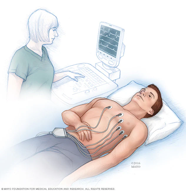 <p>A test that records the electrical activity of the heart</p>