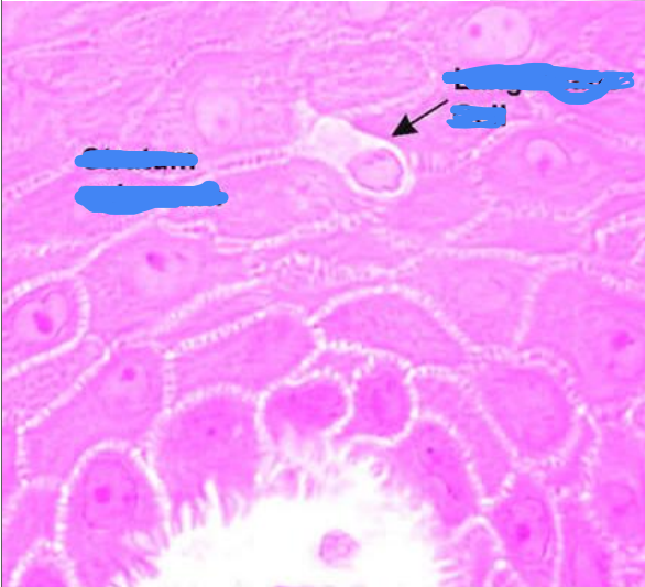 <p>Where is this, and what is the arrow pointed at?</p>