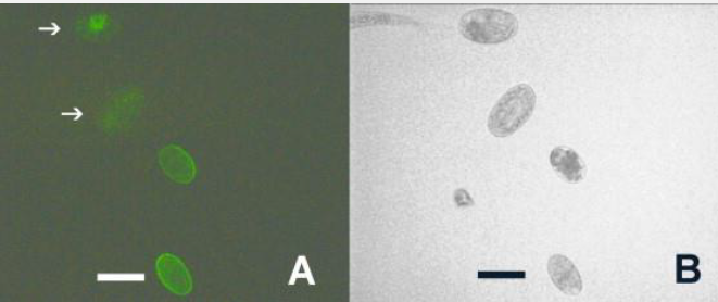 <p>Name this test and what is diagnoses</p>