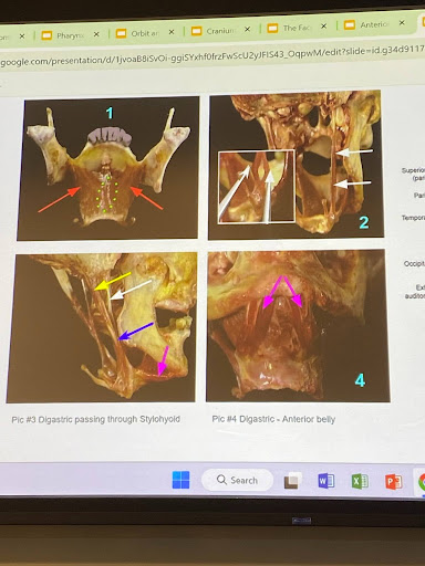 <p>Red arrow: </p><p>Yellow:</p><p>Pink: </p><p>Bottom bone: </p><p>White arrow:</p>