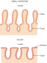 <p>Crypts/Villi</p>