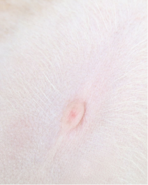 <p>Q: The pit in the abdominal wall marking the point where the umbilical cord entered the fetus, also called “NAVEL”, is the ……. </p><p>A. Umbilicus </p><p>B. Condyle </p><p>C. Fossa </p><p>D. Foramen</p>