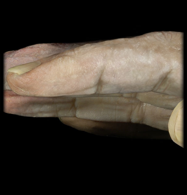 <p><span>Dermis</span></p>