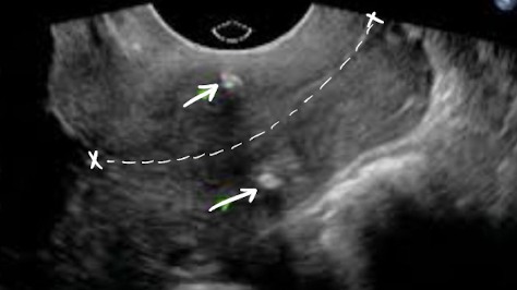 <p>what are the arrows pointing to?</p>