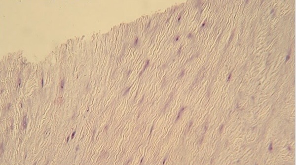 <p>NTK: what type of cartilage is this </p>