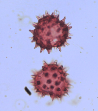 <p>Identify the pollen grains to the <strong>Family </strong>level</p>