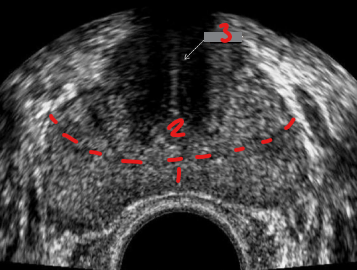 <p>Identify this image. </p>