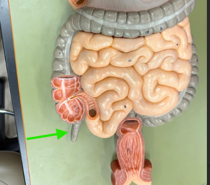 <p>What is the arrow pointing at?</p>