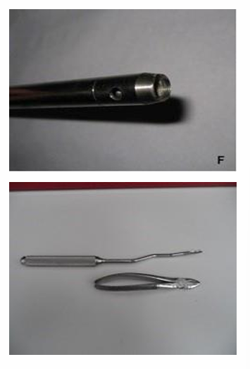 <ul><li><p>Specialist kit —> incl. apple-core device (Burgess elevator) to go around tooth </p></li><li><p>Can use a long handled elevator / small animal tooth luxator & pair of SA forceps</p></li></ul><p></p>