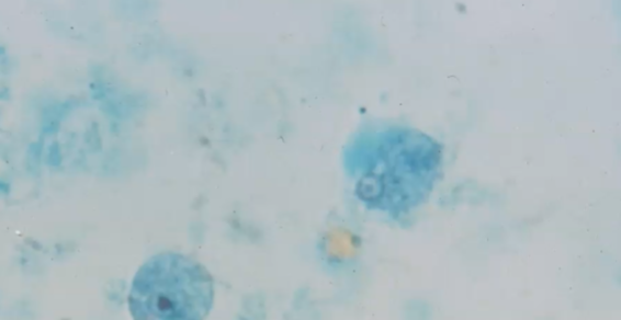 <p><span>Which TWO parasites are seen here and how did you differentiate them?</span></p>