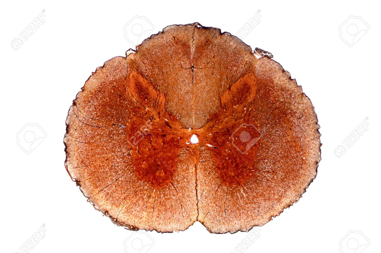 <p>Au centre, en forme d'H qui contient les corps cellulaires des neurones, dendrites et les synapses.</p>