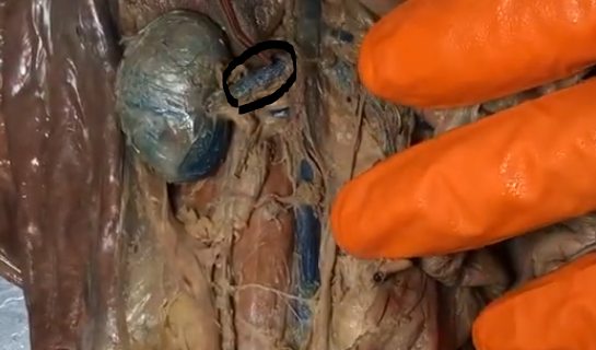 <p>What vessel is this?</p>