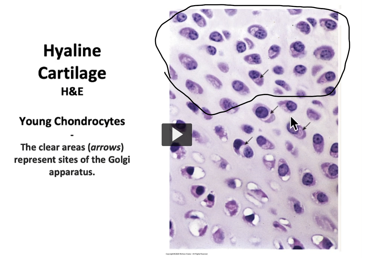 <p>For example, in this slide seen previously, where we saw the C of mature chondrocytes forming part of mature cartilage tissue (at the top) </p>