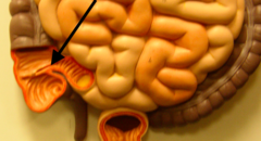 <p>located between the ileum and the cecum</p>
