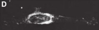 <p>a type of light microscope, makes the cytoplasm dark, useful for small living organisms invisible in brightfield or any object that’s refractive value is similar to the background</p>
