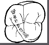 <p>Oblique ridge: transverse ridge, characteristics of maxillary molars </p><p>Formed by the triangular ridges of the mesiopalatal and distobuccal cusp</p>